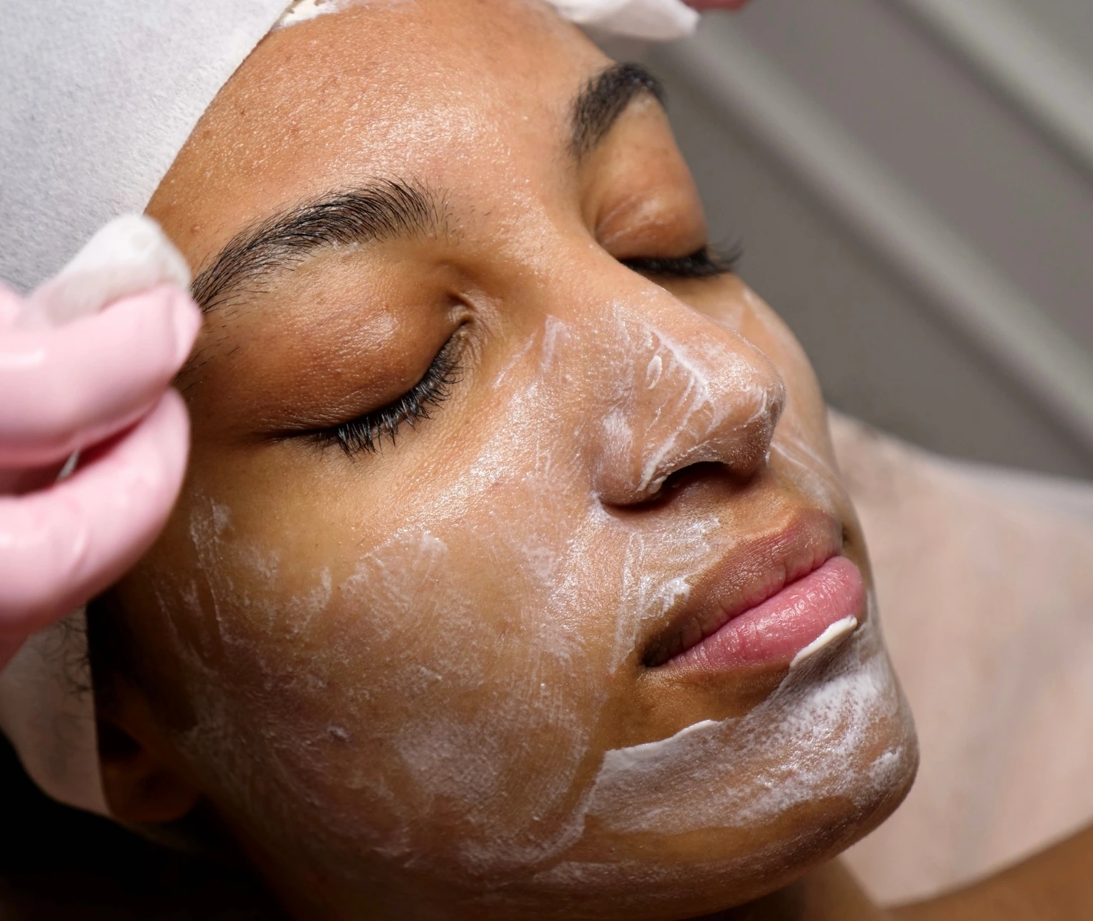 prp facial jumeirah