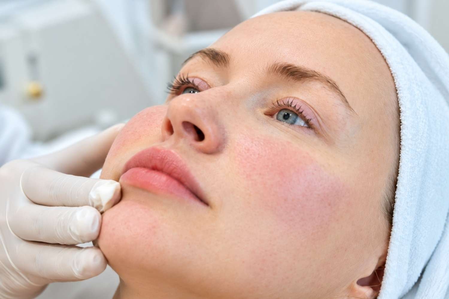 Skin booster treatment jumeriah